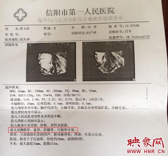 胎兒醫(yī)院四維彩超顯示一切正常 出生后肢體殘缺